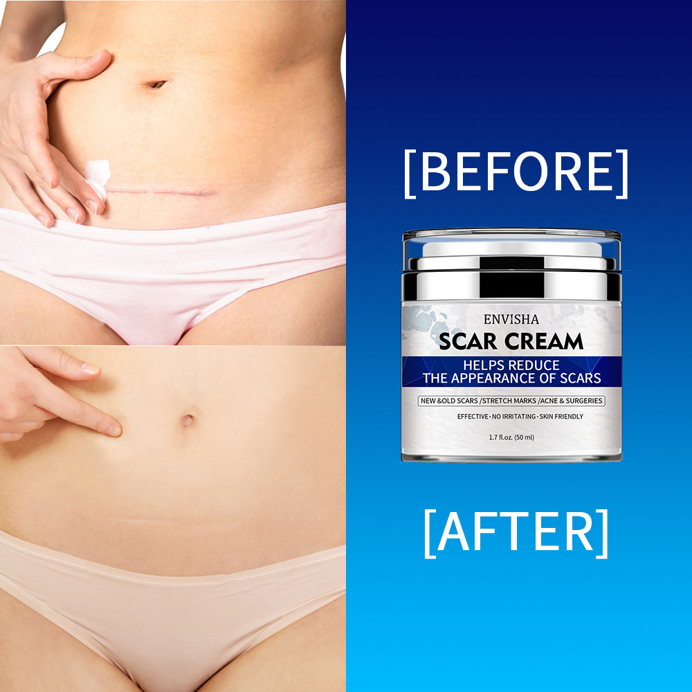 Crème Naturelle cicatrices et vergetures